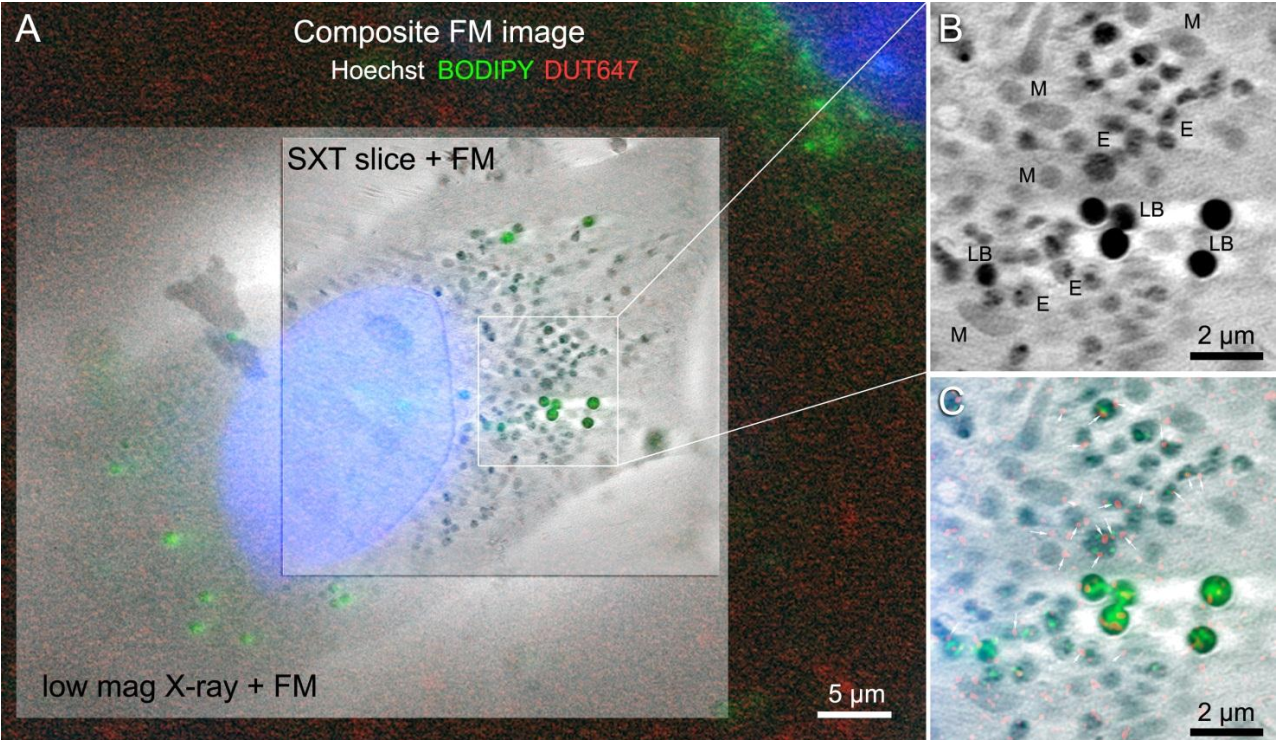 无需同步辐射！实验室软 X 射线技术，实现非标记纳米细胞 3D 成像