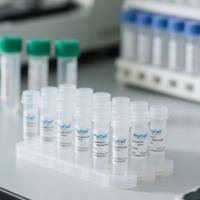 鼠抗人蛋白16单克隆抗体；人蛋白16抗体；P16蛋白抗体；P16抗体