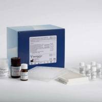 单标信号放大试剂盒Plus版（TYR620/兔鼠通用二抗）