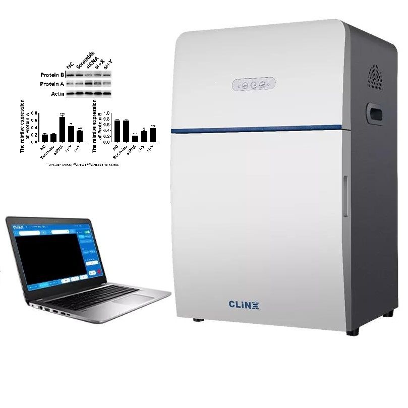 Western Blotting（蛋白免疫印迹）