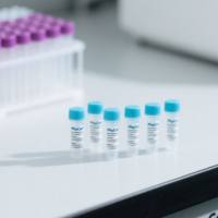 鼠抗人精子SP10蛋白单克隆抗体;人精子SP10蛋白抗体;精子蛋白抗体;SP10-mAb