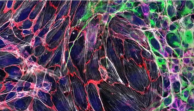 「走」为上策：细胞迁移中的「生」与「病」