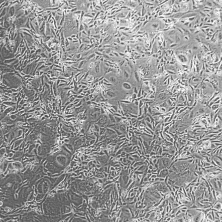 59M_人卵巢癌细胞