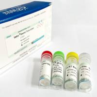 Seebio® 逆转录酶（含dNTP）