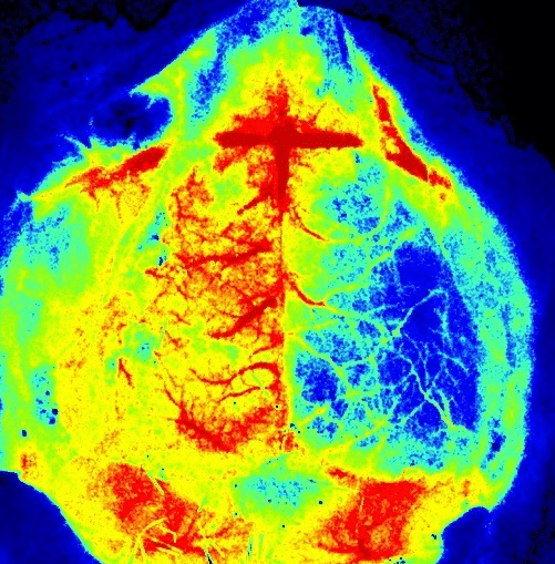 激光散斑血流仪 PeriCam PSI