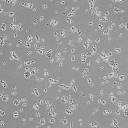 CAL 33_人舌鳞状细胞癌