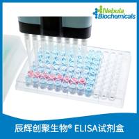 人对称二甲基精氨酸(SDMA)ELISA试剂盒 | Human Symmetric Dimethylarginine(SDMA) ELISA Kit