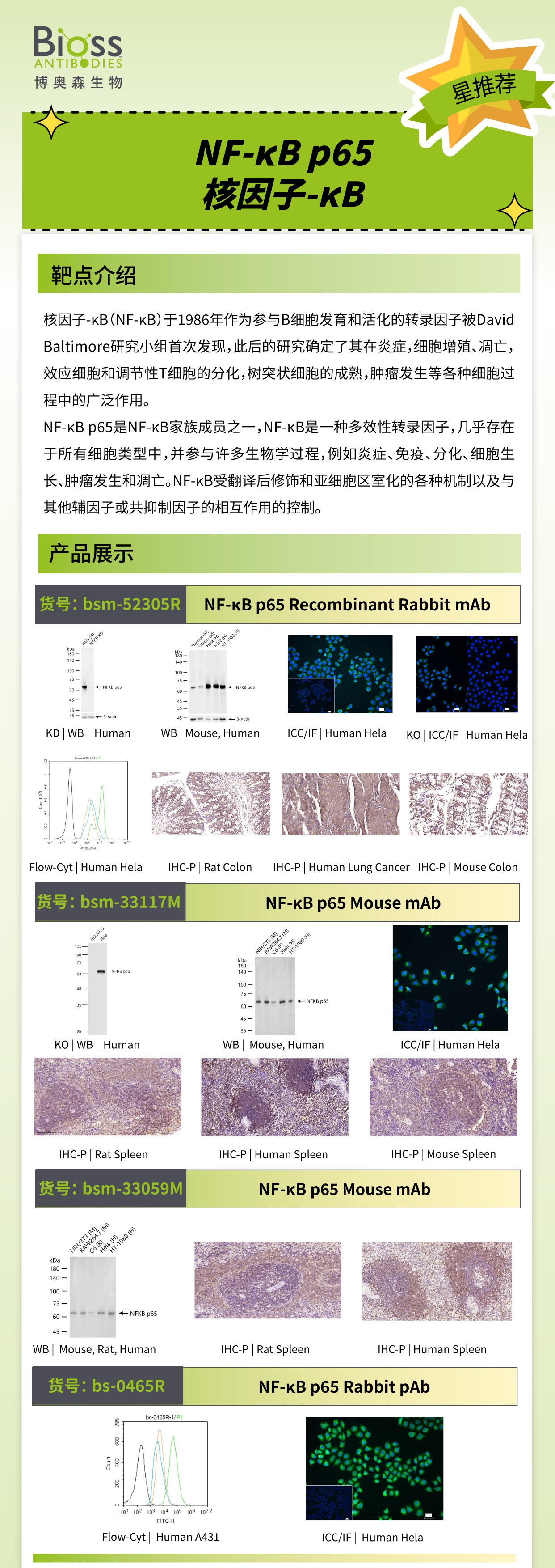 Bioss 星推荐 | NF-κB p65抗体