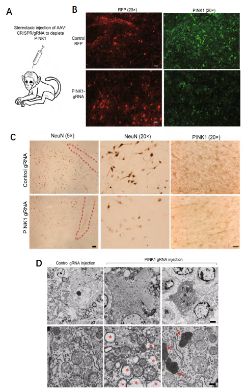 带你了解：PD建模技术及非人灵长类动物模型