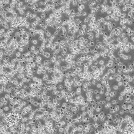 Reh_人白血病细胞