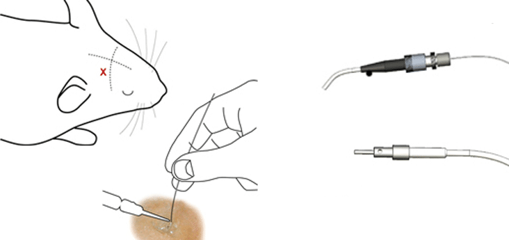 激光散斑血流仪 PeriCam PSI