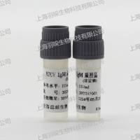 康彻思坦戊型肝炎病毒抗体血清(液体)标准物质
