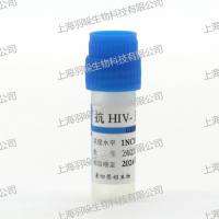 康彻思坦人类免疫缺陷病毒I型抗体血清(液体)标准物质