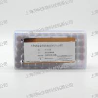康彻思坦HIV 抗体血清盘
