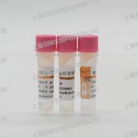 康彻思坦柯萨奇病毒A16型IgM抗体(CA16 IgM)(液体)质控品