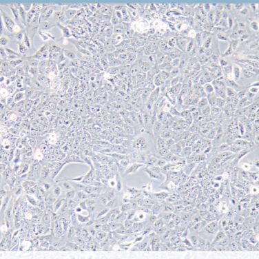 大黄鱼肾细胞;PCK