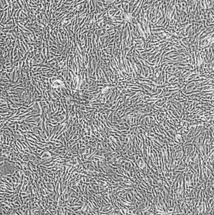 NCI-H1975