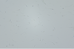 实验动物模型（实操）--精子涂片如何评估小鼠生育力