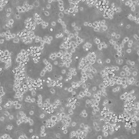 Jiyoye_人淋巴癌细胞