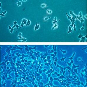 默克Merck INS-1 832 3 cells Rat Insulinoma Cells
