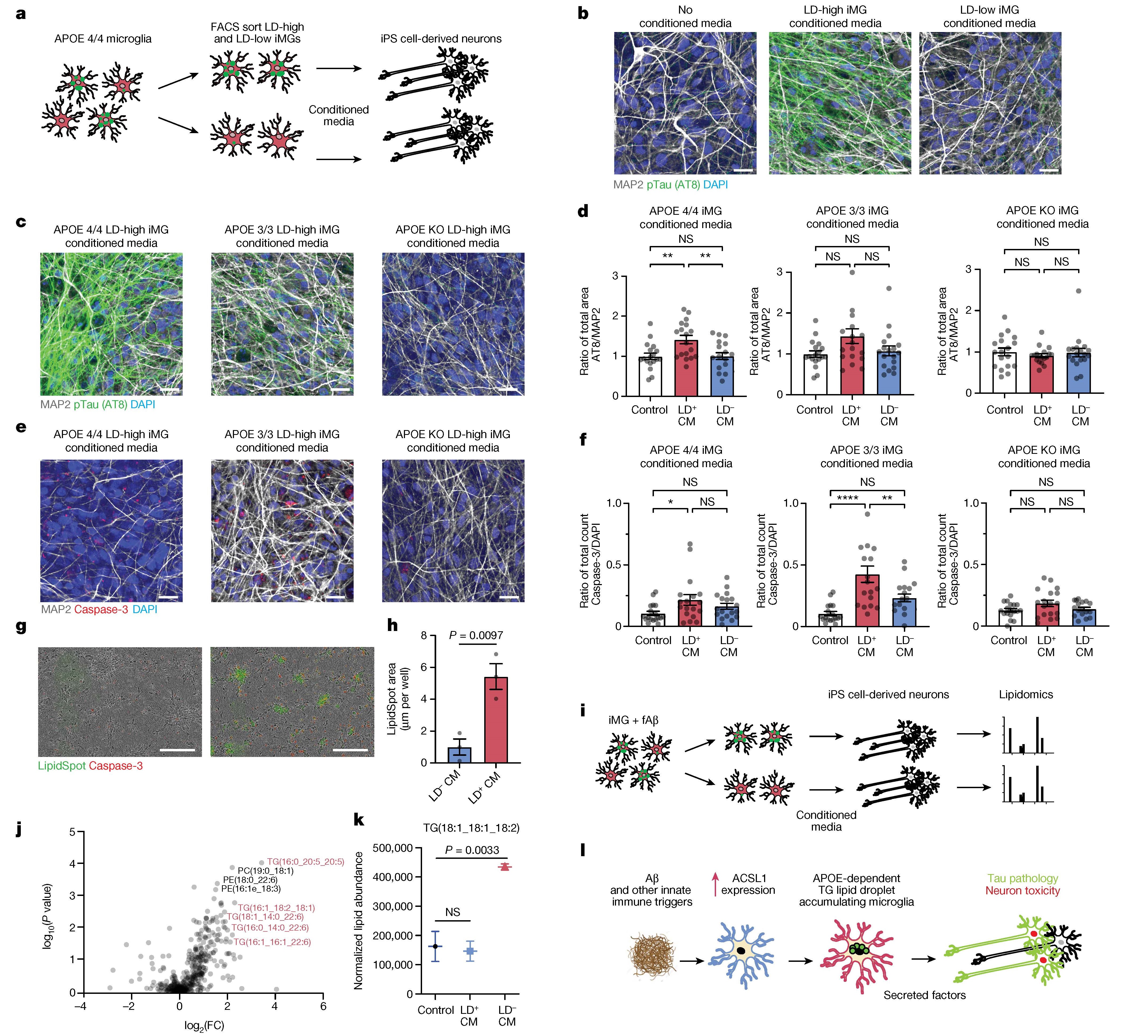 Nature |APOE4/4基因与阿尔茨海默病:iPSC+单细胞转录组助力发现小胶质细胞中的脂滴之谜