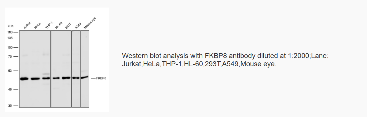 K115956P Anti-FKBP8 Polyclonal