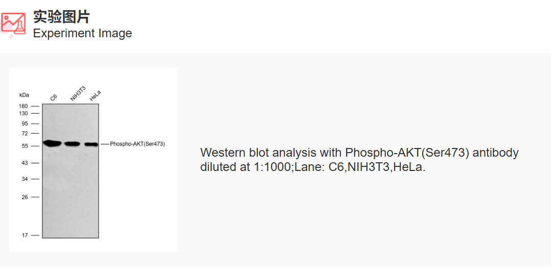 K011543M Anti-Phospho-AKT(Ser4