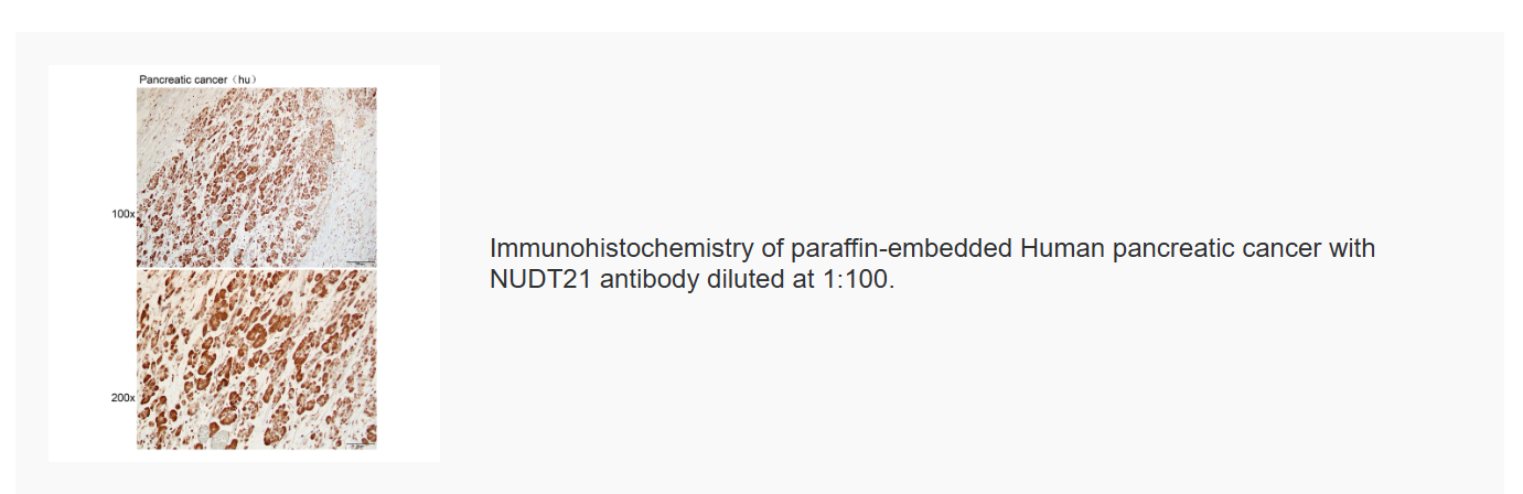 K115963P Anti-NUDT21 Polyclona