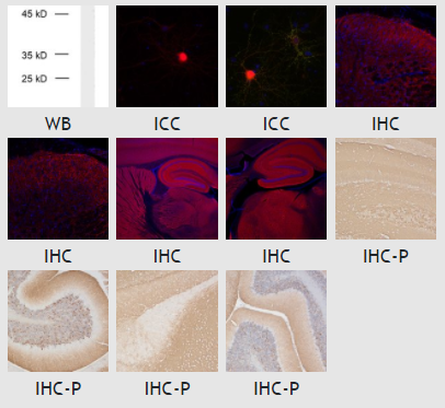 α-突触核蛋白抗体-128 208，劳动节限时抢购