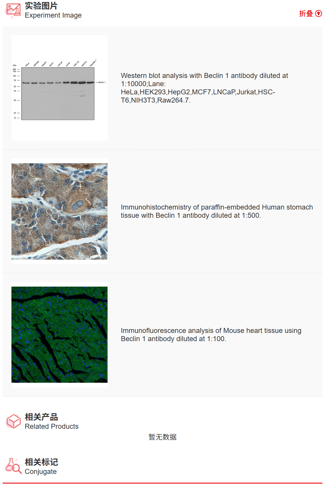 K011487M Anti-Beclin 1 Monoclo