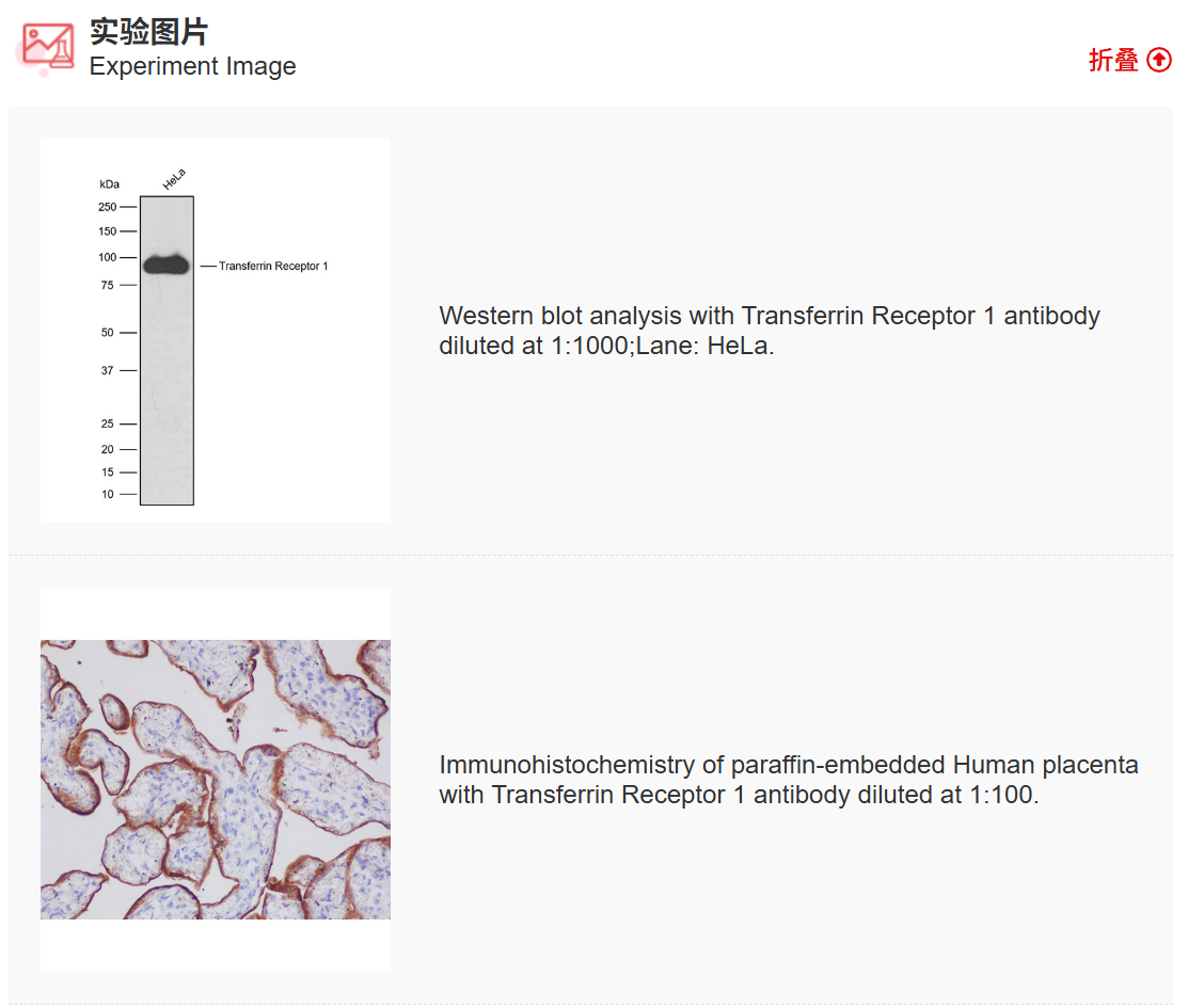 K011494M Anti-Transferrin Rece