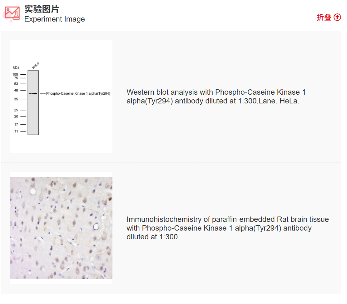 K011516P Anti-Phospho-Caseine 