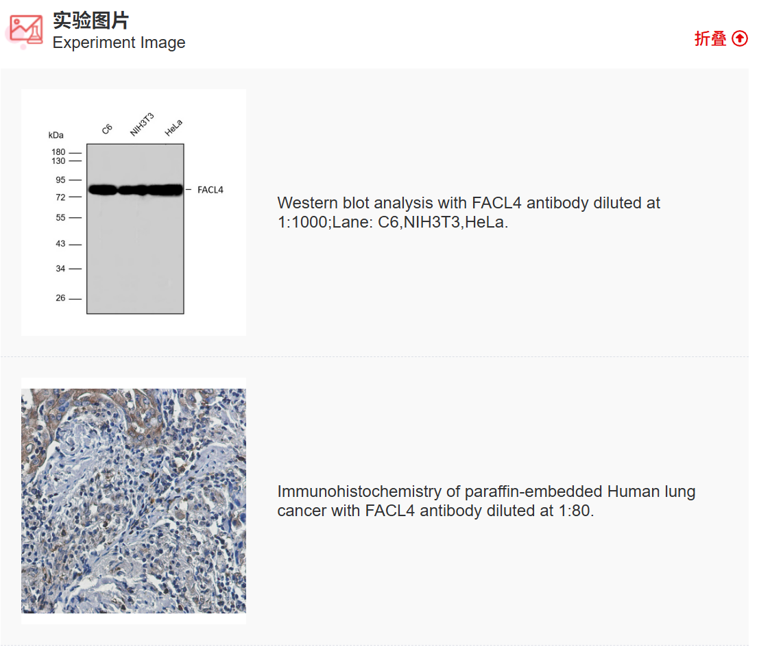 K011493M Anti-FACL4 Monoclonal