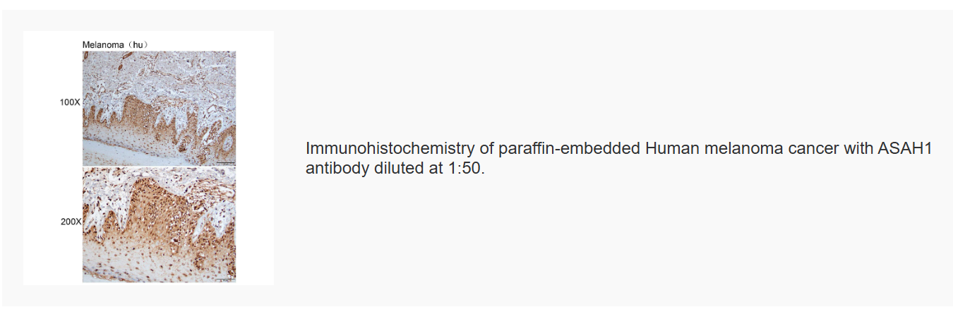 K115957P Anti-ASAH1 Polyclonal