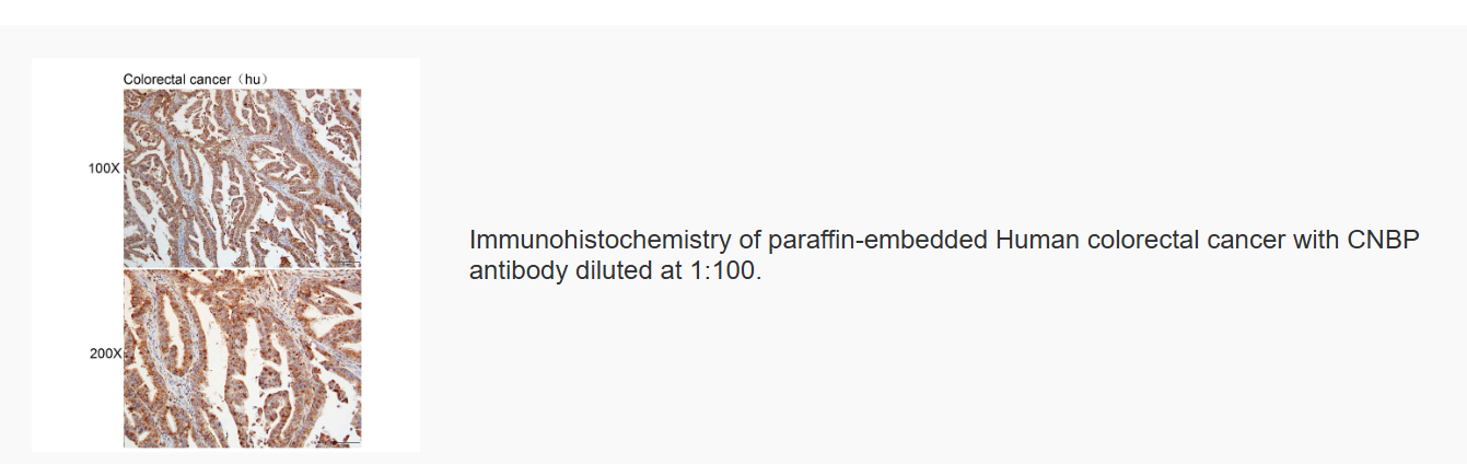 K115954P Anti-CNBP Polyclonal 