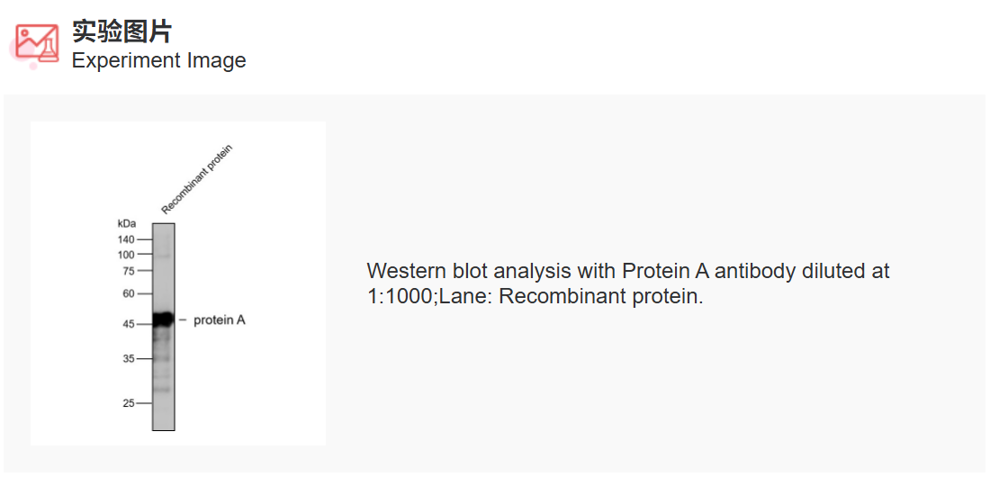K011563P Anti-Protein A Polycl