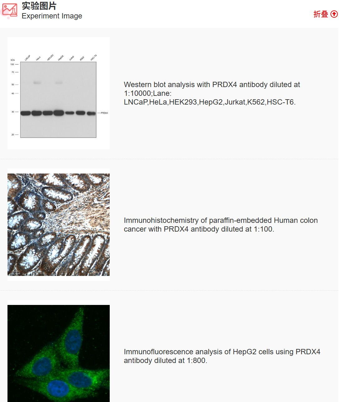 K011496M Anti-PRDX4 Monoclonal