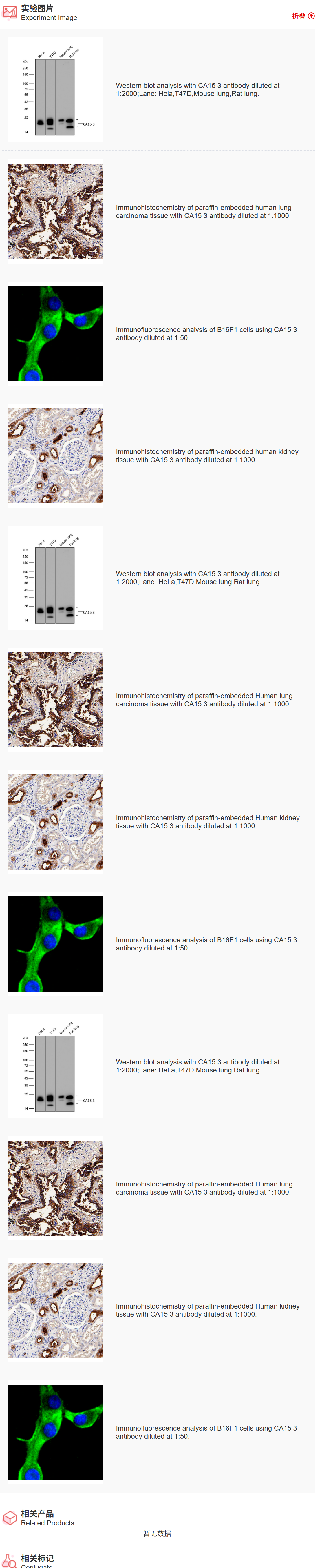 K011532M Anti-CA15 3 Monoclona
