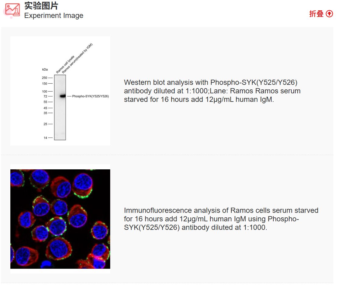K011491M Anti-Phospho-SYK(Y525