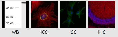 α-微管蛋白抗体-302 008--限时折扣，不要错过~