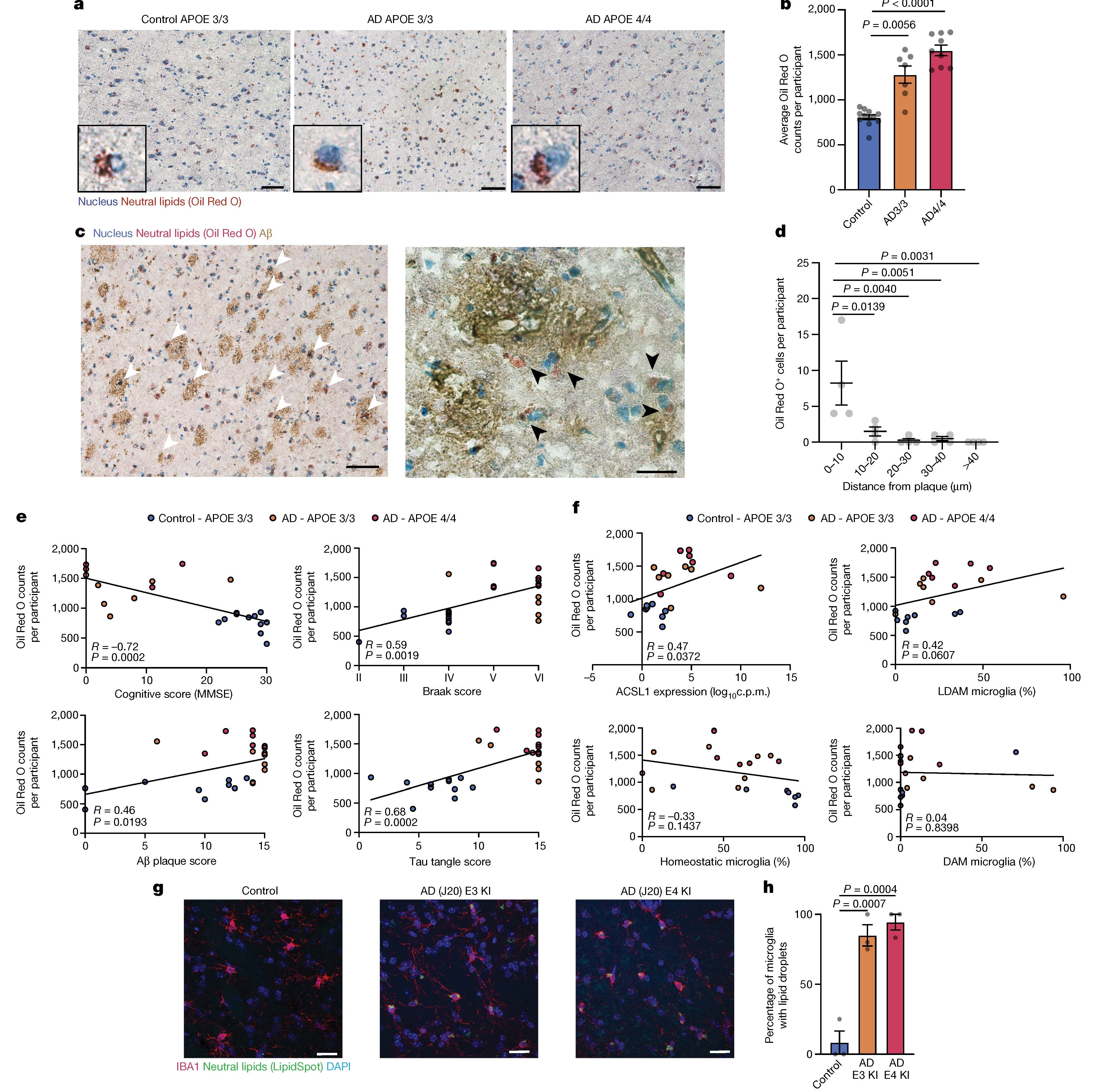 Nature |APOE4/4基因与阿尔茨海默病:iPSC+单细胞转录组助力发现小胶质细胞中的脂滴之谜