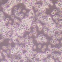 K7M2wt-FLUC-puro小鼠骨肉瘤成骨细胞(FLUC标记)