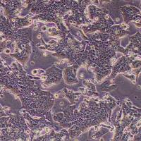 IM95m人胃癌细胞(STR鉴定)