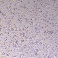 HCerEpiCs-SV40T人宫颈上皮细胞永生化