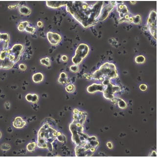 细胞培养新手答疑贴（内含污染、传代、复苏的问题及解答）