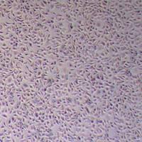 HCC1954人乳腺导管癌细胞（STR鉴定正确）