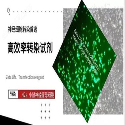 小鼠神经母瘤细胞转染试剂