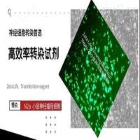 小鼠神经母瘤细胞转染试剂