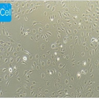 HUVEC人脐静脉内皮细胞永生化