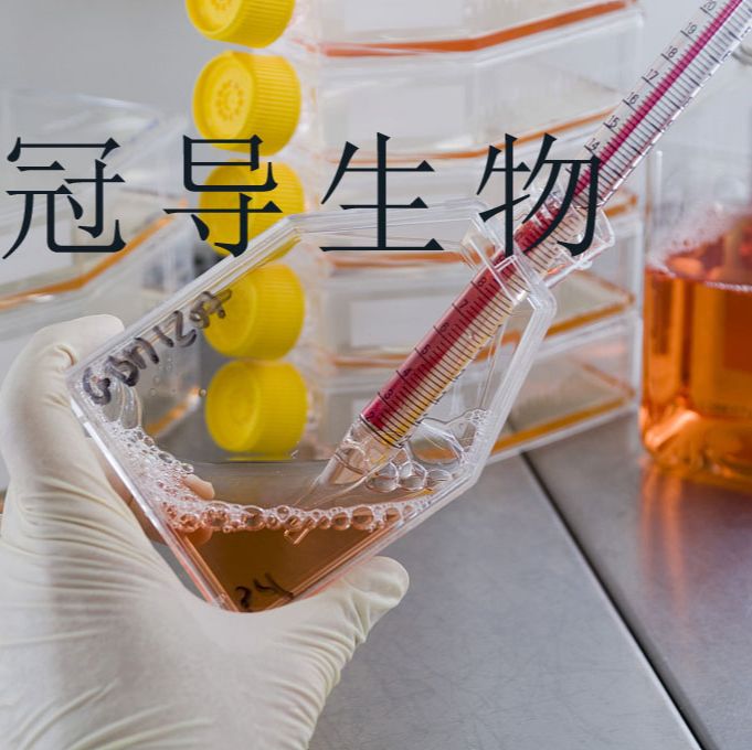 Caco-2 Cells人结直肠腺癌细胞实验室复苏|STR图谱